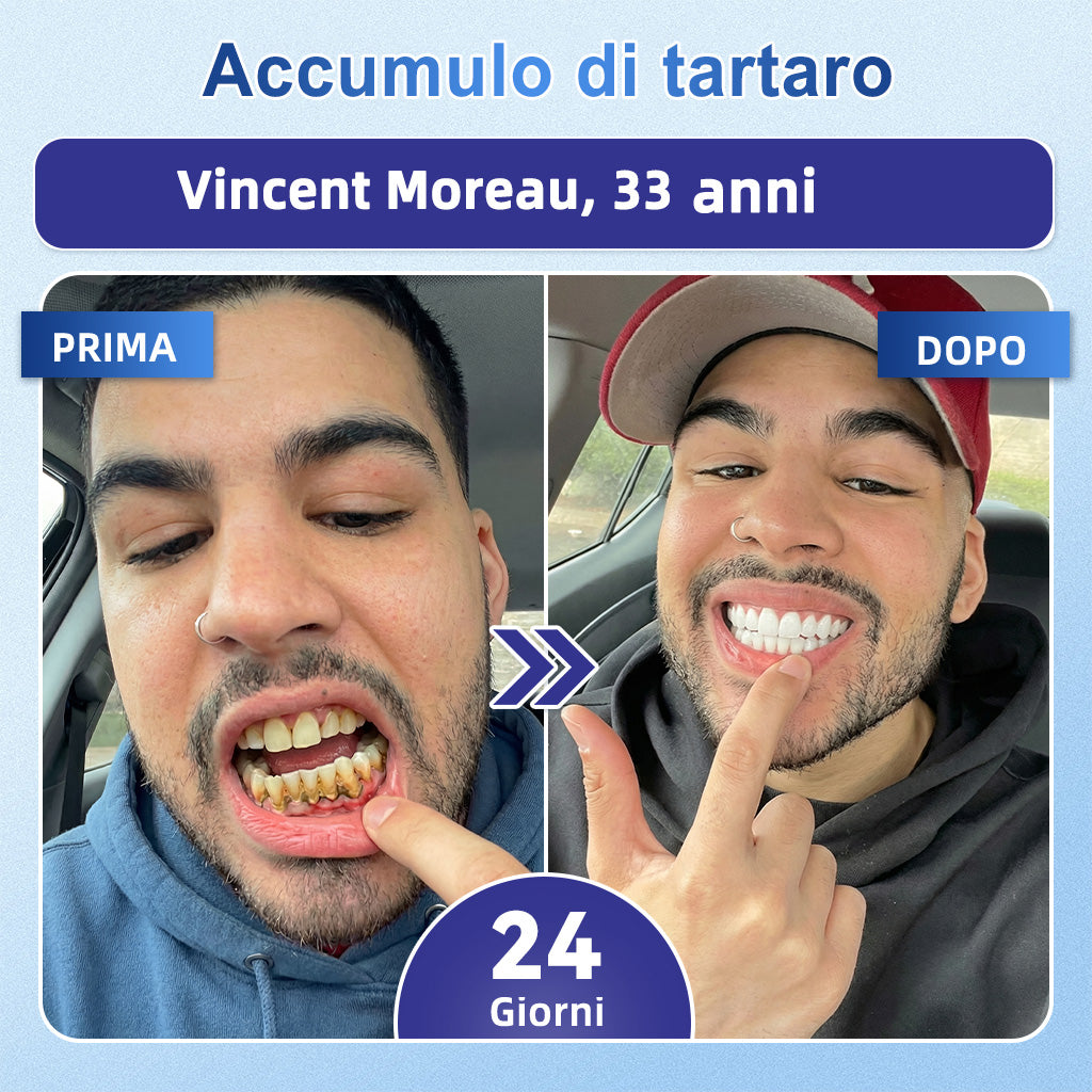 🦷 Dì Addio a Sensibilità e Fastidi! 𝐃𝐫.𝐄𝐫𝐚® Tideglusib Strisce Orali – Riparazione Rapida per Denti e Gengive 😊